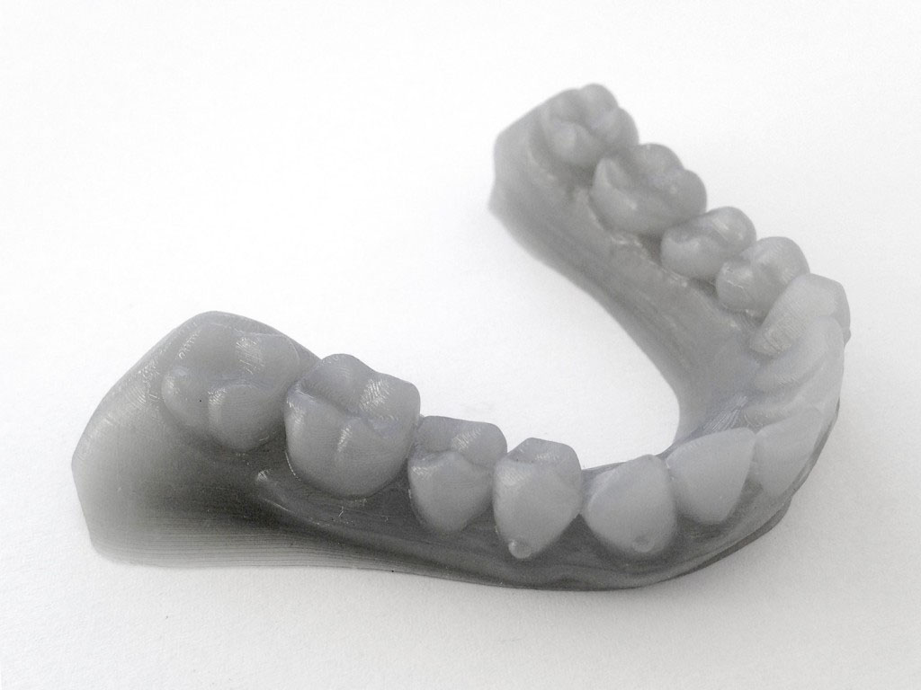 teeth 3dprinting gray resin science